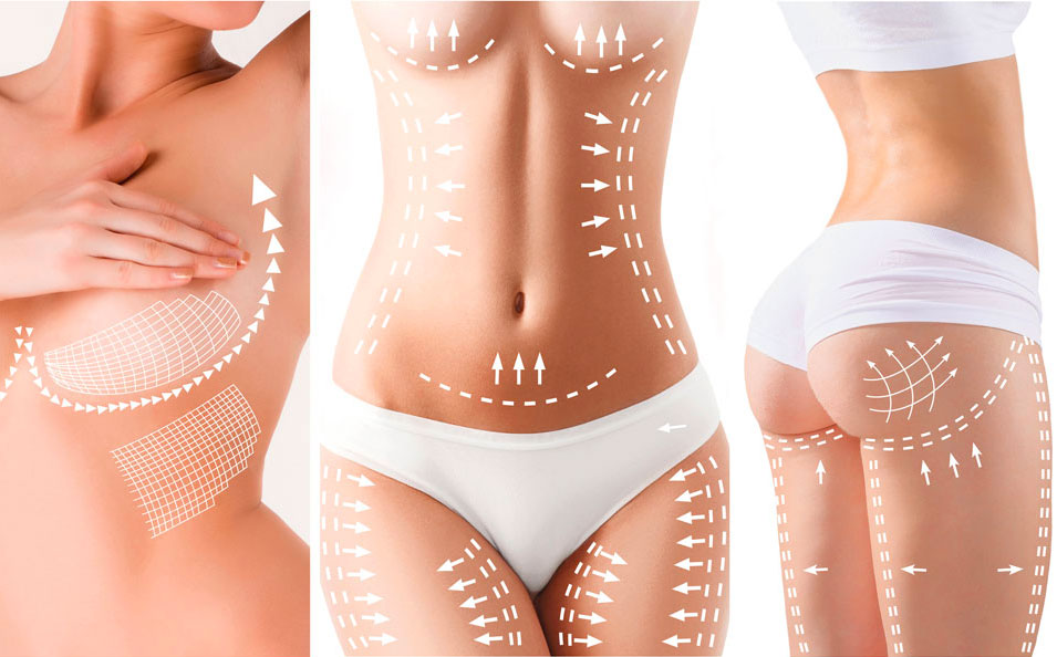 medicina estetica corporal